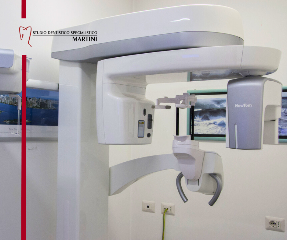 Radiografie dentali digitali: diagnosi completa e tempi rapidi