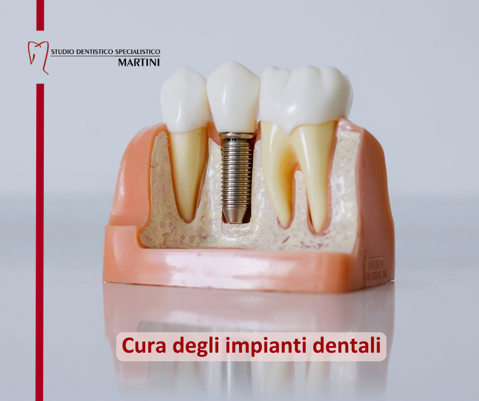 Cura degli impianti: la guida completa