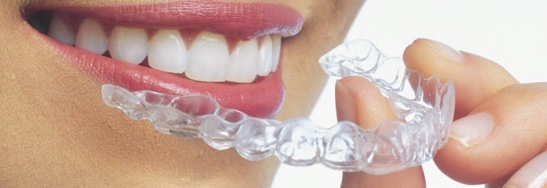 Mascherine dentali trasparenti
